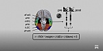 When the Brain Suddenly Sees