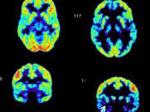 The Brain of a Sociopath